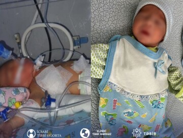В КМЦ спасли жизнь ребенку с врожденным пороком сердца и пневмонией