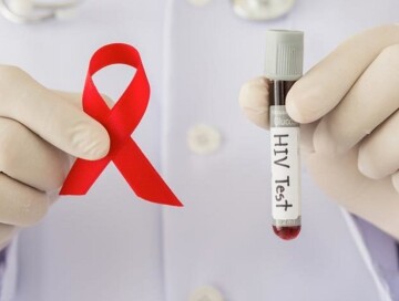 В Азербайджане с начала года выявлено 695 случаев ВИЧ